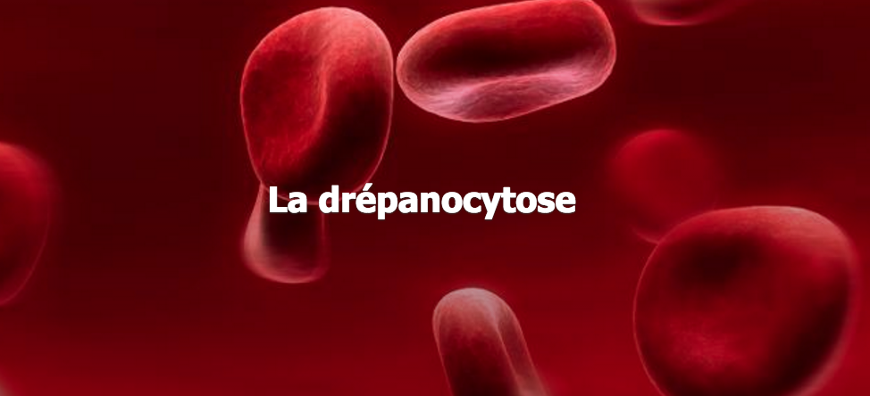 Drépanocytose